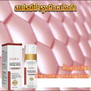 EELHOE  สเปรย์ซ่อมแซมผิวคล้ำ   ซ่อมแซมข้อต่อรักแร้ทำความสะอาดดำเคราตินสเปรย์ฟอกสีฟัน