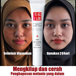 flek hitam membandel di wajah salep cream penghilang flek hitam cream penghilang flek tebal niacinamide