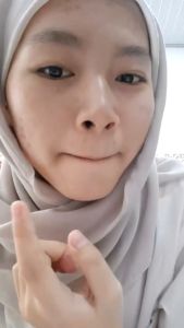 Ardiras Skincare Acne Day Night Cream Krim Malam Jerawat Atasi Bekas Jerawat Flek Hitam di Wajah Kulit Sensitif Mengurangi dan Meredakan Jerawat With Sulfur 10gr BPOM