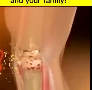 Lumbar Part-Type Cold Compress Gel & Soreness Relief