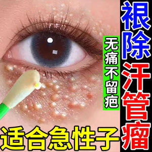 Sweat Duct Tumor Eye Remover Special Ointment Water Fat Granule Eye Removing Particles Eliminate Eye Face Yellow Tumor Eye Cream