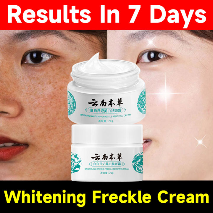 20g Japanese Melasma Cream Melasma Cream From Japan Yunnan Herbal Whitening Freckle Cream 5563