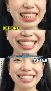 Buy 1 Get 2 Scoban Whitening Toothpaste Japan Hyaluronic Acid Dual-Effect teeth Whitening Toothpaste
