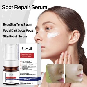 Spot Repair Serum For Dark Spots Even Skin Tone Serum Facial Dark Spots Repair Vitamin B5 Serum Facial Dark Spots Repair Cleanser Skin Repair Serum Daily Skin Rejuvenation