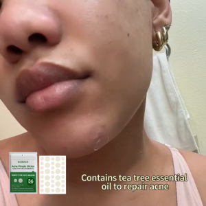 WEST&MONTH Acne Pimple Sticker Hydrocolloid Stickers Removal Acne Facial Skin Care 24pcs