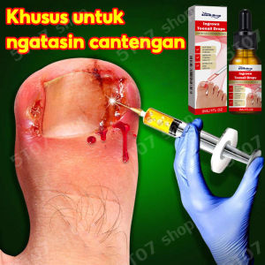 obat jamur kuku Obat Cantengan 10ml Serum Kuku Jamur dan Rusak obat centengan obt jamur kuku obat kuku jamur dan rusak serum kuku halal nail care Jempol Obat Cantengan Jempol Kaki Obat Kuku Bengkak Obat Kuku Kaki