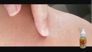 YELLOW PEELING OIL 15ML / UNDERARM / BODY