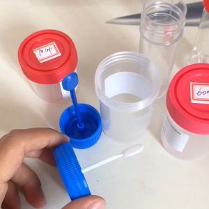 20 Pcs Containers Fecal Specimen Bottle 15 Ml Screw Waste Specimen Bottle