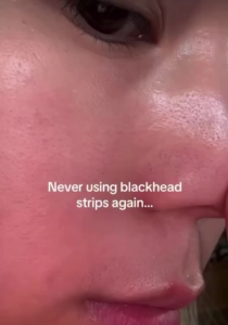 Anua Heartleaf Pore Control Cleansing Oil 200ml – Remove Makeup Dissolve Impurities Soothe & Balance for Sensitive Skin