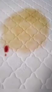 DKOYO 500ML Eco-Friendly Mattress Cleaning Agent to Remove Stubborn Stains