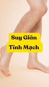 Trà Suy Giãn Tĩnh Mạch 40 Túi lọc tra dong y viet