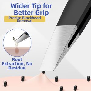Beginner-Friendly Blackhead Remover Tweezers plys
