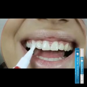 Jaysuing Teeth Whitening Pen Remove Dental Plaque Clean Bleaching Reduce Smoke Tea Coffee Stains 5ml
