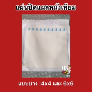 P30: แผ่นปิดแผลแบบ หนังเทียม ปิดแผล Hons แบบบาง แผ่นบางเฉียบ แผ่นแป็กแผล วัสดุไฮโอดเกอร์ มี 2 ขนาด แผ่นปิดแผล สำหรับแผลกดทับ แผลผ่าตัด แผลเบาหวาน แผลเรื้อรัง น้ำเหลืองมาก แผลชูมาก หายยาก ดูดซับแผล แผลแห้ง หายเร็ว