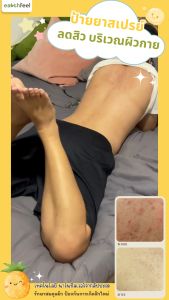 (พร้อมส่ง) โปรสุดคุ้ม!!  Earthfeel สเปรย์ฉีดหลัง จากเทคโนโลยี “สับปะรดนาโนซิลเวอร์” มีผลวิจัยรองรับ