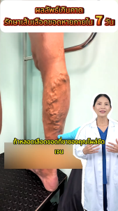 【OFFICAL】Kreain Nature เจลลดปวดขา ช่วยแก้ปัญหาอาการปวดกล้ามเนื้อขาและเส้นเลือดขอด รวมถึงข้อกังวลอื่นๆ