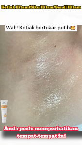 Vitamin C Tone Up Cream  underarm whitening cream  under arm whitening  Private Parts Whitening  Fading Melasma Dark Spots Acne Marks   Hydrating Anti Aging  Smoothing Skin  Non-Greasy  for dark areas  for sensi  Men & Women  50g