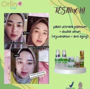 Paket Flek Skincare Orlin Beauty + Serum Rejuvenation / Paket Glowing / Flek Bandel Pudar