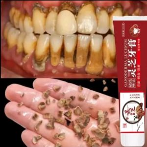 GANODERMA LUCIDUM Pasta Gigi ORI Penguat Gigi Goyang Menyembuhkan Sakit Gigi Berlubang