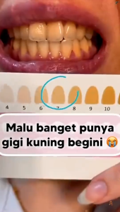 Breylee Probiotic Pearl Whitening Tooth Paste 30gr-Pasta Gigi