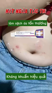 Kem for muỗi đốt chàm hăm ẩm ướt da nhanh chóng Nấm King giảm ngứa toàn thân hộp trắng WJG