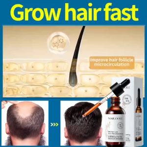 【Fast Effective 】Hair Growth Serum Ginger Hair Tonic 30ML Hair Growth For Men And Women Anti Hair Loss Preventiom Prevents Balding Hair Growth Supplement