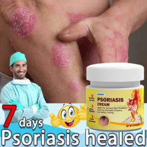 🌟【READY STOCK】🔥Psoriasis Ointment Eczema Ointment Anti-Itch Topical Itchy Skin Psoriasis Wetren Prickly Heat Care Cream 20g/box