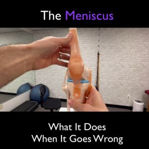 Model Anatomi Sendi Lutut Manusia & Flexible Skeleton Model untuk Belajar Medis