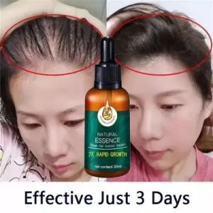 EELHOE Hair Growth Serum Penumbuh Rambut Wanita Pria Secara Cepat - Serum Rambut Rontok / Obat Penumbuh Rambut Botak Mirip Red Ginseng Hair Tonic Minyak Kemiri 30ml