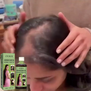 He Shou Wu Herbal Hair Oil 100 ml Rosemary Formula: Repairs damaged hair moisturizes the scalp and reduces dandruff
