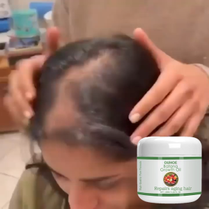 Ouhoe Batana Hair Oil Hair Growth Nourishes Hair Follicle Strengthens Roots Anti Loss Repair Dry Hair Scalp Care Oil Reduce Damaged Deeply Moisturizing Repairing Curls Hair Oil