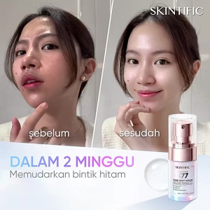 SKINTIFIC Symwhite 377 เซรั่มลดเลือนจุดด่างดำ 20ml/50ml（เพื่อผิวหน้ากระจ่างใส）เนื้อสัมผัสบางเบา ลดเลือนจุดด่างดำ