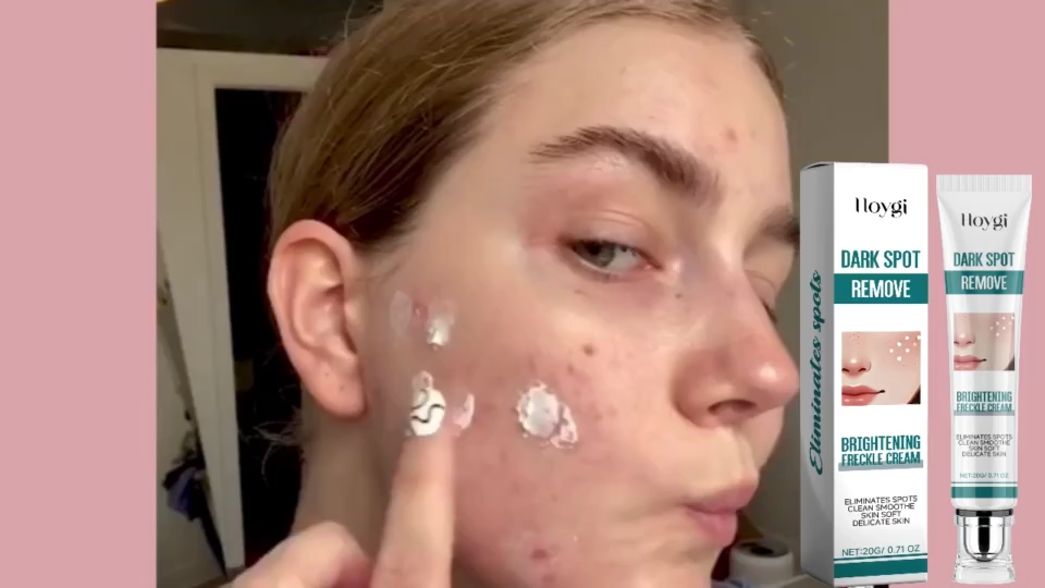 Melasma Cream Original Pekas Remover Anti Melasma Cream Effective for Dark Spots Freckles Face Care 20g