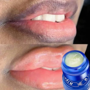 Lip Balm Whitening Remove Dark Lighten Melanin Lip Mask Fade Lip Line Brighten Exfoliating Moisturize Dead Skin Repair Lip Care