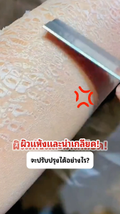 COD [ซื้อ 2 แถม 2] สบู่กำมะถันและเจลอาบน้ำ 3- in-1 สูตรปรับปรุงใหม่ใช้กำมะถันและสารสกัดจากพืชเพื่อ กำจัดไรฝุ่น อ่อนโยนต่อผิวและไม่ทำให้เกิดการระคายเคือง โลชั่นคอลลาเจนทองคำ ช่วยให้ ผิวกายชุ่มชื้น 300ml ความชุ่มชื้น