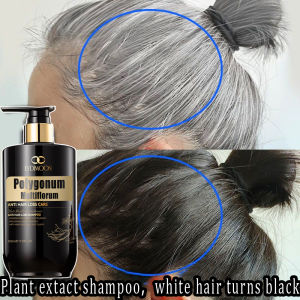 Natural Black Hair Shampoo White Hair To Black Herbal Shampoo Anti Hair Loss Suitable For Oily Scalp Severe Hair Loss Black Hair Shampoo Strengthens Hair Roots Grow Thick Black Hair