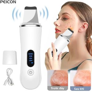 Máy Chà Mặt Siêu Âm Máy Lột Da Máy Tẩy Mụn Đầu Đen Máy Làm Sạch Lỗ Chân Lông Có Thể Sạc Lại Thiết Bị Chăm Sóc Da Mặt