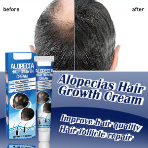 【BUY 1 TAKE 1】Alopecias Hair Growth Cream Regrowth Repairing Prevent Hair Loss Fast Hair Growth Fast Hair 20g