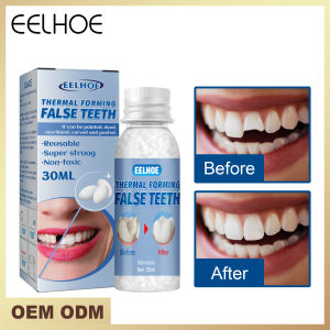 【Hot Sale】Eelhoe False Teeth Filling Solid Glue Thermal Forming Denture Solid Tooth Gel Temporary Tooth Repair Kit Teeth Beauty Tool Denture Adhesive Broken Teeth And Gaps Restoration Dental Veneers Resin False Teeth Filling Glue