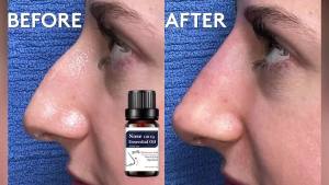 New-Nose Lift Up Heighten Rhinoplasty Oil  Heighten Rhinoplasty Nasal Bone Remodeling Pure Natural Care Thin Smaller Nose