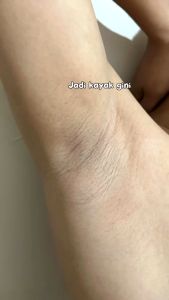 Deodorant Tawas Spray Deodoran Air Penghilang Bau Ketiak Badan Hilang Permanen Ampuh Original Bpom