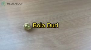 Bola Duri Magnet Kecil Akupuntur Untuk Kesehatan