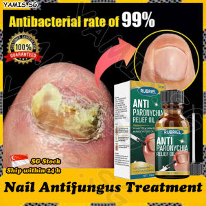 👒𝙎𝙂 𝙎𝙏𝙊𝘾𝙆👒 Nail fungus treatment liquid / Anti paronychia relief oil / Ingrown toenail treatment / Nail repair serum / 甲沟炎