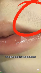 ALAT PENCABUT BULU WAJAH epi roller hair remover ALAT CABUT BULU TANGAN CABUT BULU BADAN ALAT CABUT KUMIS FACE EPIROLLER