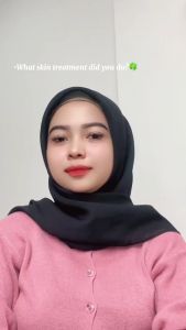 CJBC Sunscreen: Mencegah Kulit Terbakar dengan SPF 50 PA+++ BPOM Halal