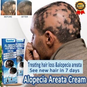 Alopecia hair growth cream 20g Hair fall treatment Hair loss cream Alopecia areata Baldness treat Rapidly repair hair follicles and regenerate hair
