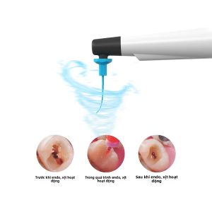 Đầu Tay Khoan Siêu Âm Không Dây Với 3 Đầu Kích Hoạt Tốc Độ Khác Nhau Dùng Trong Điều Trị Nội Nha Thiết Bị Nha Khoa Hệ Thống Điều Trị Tủy Răng Của VV DENTAL