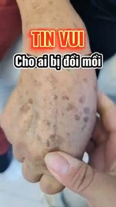 20g Nicotinamide hỗ trợ Làm trắng tàn nhang Loại bỏ dưỡng ẩm Kem dưỡng da làm sáng da