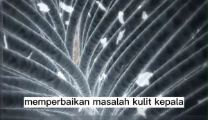 Shampoo Anti Ketombe & Sampo Anti Gatal: Pilihan Terbaik Untuk Rambut Sehat