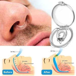 1/2/4PCS Magnetic Anti Snore Device Stop Snoring Nose Clip Easy Breathe Improve Sleeping Aid Apnea Guard Night Device with Case